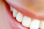Склонность к болезням может определяться количеством зубов