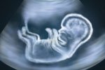 Приняты поправки по штрафам за подпольные аборты