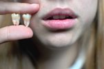 Мужчину осудили за пристрастие выдирать подругам зубы во время секса